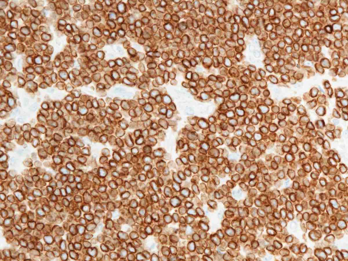 Lymph node 2012 CD3 40X